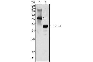 Western Blot showing MATK antibody used against K562 cell lysate (1). (MATK Antikörper)