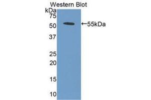 Western Blotting (WB) image for anti-Bone Morphogenetic Protein 5 (BMP5) (AA 317-454) antibody (ABIN3205479) (BMP5 Antikörper  (AA 317-454))
