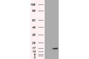 HEK293T cells were transfected with the pCMV6-ENTRY control (Left lane) or pCMV6-ENTRY TTC32 (Right lane) cDNA for 48 hrs and lysed. (TTC32 Antikörper)