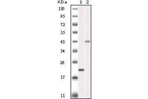 Western blot analysis using AURKB mouse mAb against truncated AURKB recombinant protein (1) and SKN-SH cell lysate(2). (Aurora Kinase B Antikörper)