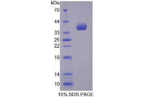 SDS-PAGE (SDS) image for Arachidonate 12-Lipoxygenase, 12R Type (ALOX12B) (AA 389-701) protein (His tag) (ABIN4989709) (ALOX12B Protein (AA 389-701) (His tag))