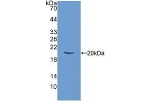 Detection of Recombinant EIF2aK3, Mouse using Polyclonal Antibody to Eukaryotic Translation Initiation Factor 2 Alpha Kinase 3 (EIF2aK3) (PERK Antikörper  (AA 973-1114))