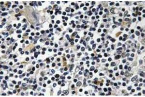 Immunohistochemistry (IHC) analyzes of p-Op18 antibody in paraffin-embedded human thymus gland tissue. (Stathmin 1 Antikörper  (pSer16))