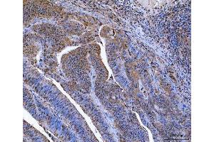 IHC analysis of Glutathione Reductase using anti-Glutathione Reductase antibody (ABIN5693151).