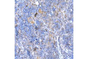 Immunohistochemistry of paraffin-embedded mouse spleen using M Rabbit pAb (ABIN3021414, ABIN3021415, ABIN3021416 and ABIN6215021) at dilution of 1:500 (40x lens). (MAGED1 Antikörper  (AA 635-834))