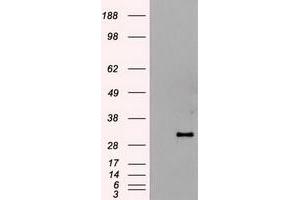 Western Blotting (WB) image for anti-Hematopoietically Expressed Homeobox (HHEX) (AA 100-270) antibody (ABIN1490798)