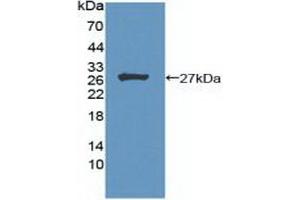 Figure. (Menin Antikörper  (AA 219-395))