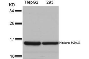 Image no. 2 for anti-H2A Histone Family, Member X (H2AFX) (Ser139) antibody (ABIN197524) (H2AFX Antikörper  (Ser139))