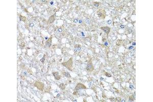 Immunohistochemistry of paraffin-embedded Rat brain using VPS37A Polyclonal Antibody at dilution of 1:100 (40x lens).