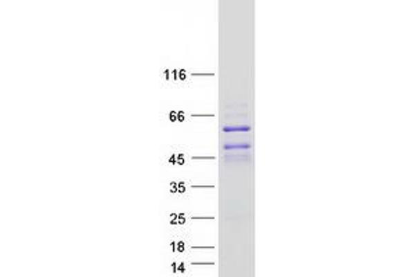 DACH2 Protein (Transcript Variant 3) (Myc-DYKDDDDK Tag)