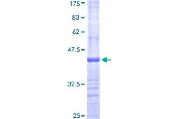 GUCY2D Protein (AA 521-630) (GST tag)