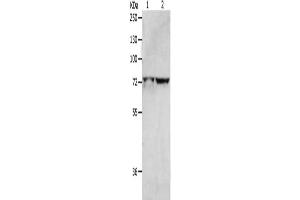 Gel: 8 % SDS-PAGE, Lysate: 40 μg, Lane 1-2: Hela cells, 293T cells, Primary antibody: ABIN7191430(MCMBP Antibody) at dilution 1/1300, Secondary antibody: Goat anti rabbit IgG at 1/8000 dilution, Exposure time: 2 minutes (MCMBP Antikörper)