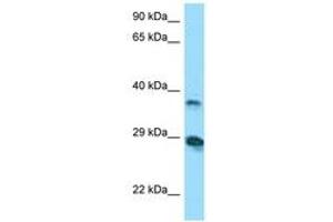 Image no. 1 for anti-V-Set and Immunoglobulin Domain-Containing Protein 4 (VSIG4) (AA 40-89) antibody (ABIN6748427) (VSIG4 Antikörper  (AA 40-89))