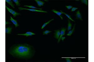 Immunofluorescence of monoclonal antibody to MMP26 on HeLa cell. (MMP26 Antikörper  (AA 152-261))