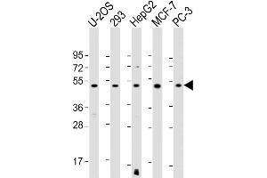 All lanes : Anti-EEF1A1P5 Antibody (C-Term) at 1:1000-1:2000 dilution Lane 1: U-2OS whole cell lysate Lane 2: 293 whole cell lysate Lane 3: HepG2 whole cell lysate Lane 4: MCF-7 whole cell lysate Lane 5: PC-3 whole cell lysate Lysates/proteins at 20 μg per lane. (EEF1A1P5 Antikörper  (AA 430-462))