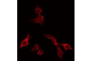 ABIN6266750 staining HeLa by IF/ICC. (NXF1 Antikörper  (N-Term))