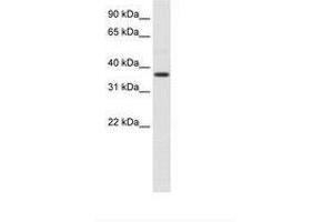 Image no. 1 for anti-alpha-2-HS-Glycoprotein (AHSG) (N-Term) antibody (ABIN6736103) (Fetuin A Antikörper  (N-Term))