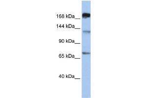 WB Suggested Anti-MTR  Antibody Titration: 0. (MTR Antikörper  (C-Term))