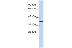 WB Suggested Anti-ZNF660 Antibody Titration:  0. (ZNF660 Antikörper  (N-Term))