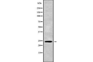 Western blot analysis of APOBEC3H using A549 whole cell lysates (APOBEC3H Antikörper  (C-Term))