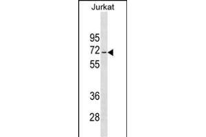 JRKL Antibody (C-term) (ABIN1537295 and ABIN2849486) western blot analysis in Jurkat cell line lysates (35 μg/lane). (JRKL Antikörper  (C-Term))