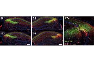 Representative confocal serial sections of mouse hippocampus infected with M1-EGFP (green) and stained with RGS14 ((ABIN1304934), 1:500, red).