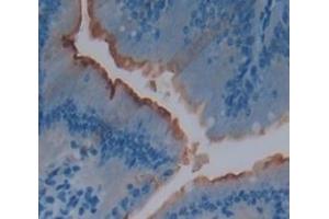 Used in DAB staining on fromalin fixed paraffin- embedded Kidney tissue (IL22R Antikörper  (AA 258-552))
