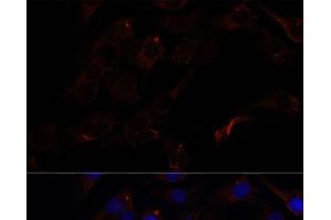 Immunofluorescence analysis of C6 cells using SEPT8 Polyclonal Antibody at dilution of 1:100. (Septin 8 Antikörper)