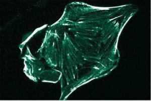 Immunofluorescence staining of HS 766T cells (Human pancreatic carcinoma, ATCC HTB-134). (Ron alpha (AA 40-224) Antikörper)