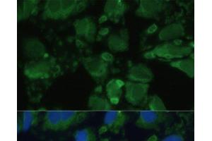 Immunofluorescence analysis of U-2 OS cells using ENO1 Polyclonal Antibody at dilution of 1:100. (ENO1 Antikörper)