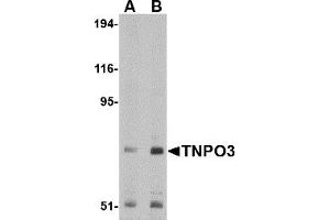 Western Blotting (WB) image for anti-Transportin 3 (TNPO3) (N-Term) antibody (ABIN1031633)