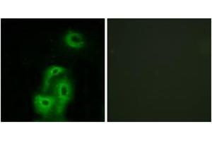 Immunofluorescence analysis of A549 cells, using 5-HT-2A Antibody. (HTR2A Antikörper  (AA 422-471))