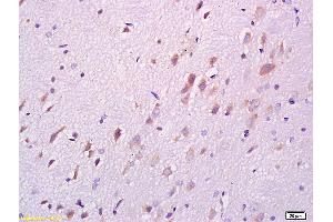 Immunohistochemistry (IHC) image for anti-Protein Phosphatase 1, Regulatory (Inhibitor) Subunit 1B (PPP1R1B) (AA 51-150) antibody (ABIN680323)