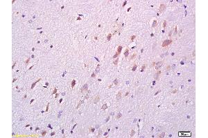 Formalin-fixed and paraffin embedded rat brain labeled with Anti DARPP32 Polyclonal Antibody, Unconjugated (ABIN680323) at 1:200 followed by conjugation to the secondary antibody and DAB staining (DARPP32 Antikörper  (AA 51-150))