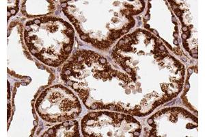 ABIN6274306 at 1/100 staining Human kidney tissue by IHC-P. (Retinol Binding Protein 5 Antikörper)