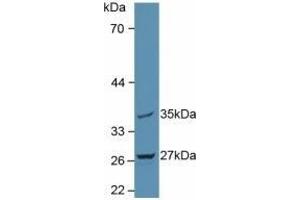 Detection of MTUS1 in Rat Brain Tissue using Polyclonal Antibody to Mitochondrial Tumor Suppressor 1 (MTUS1) (MTUS1 Antikörper  (AA 1018-1270))