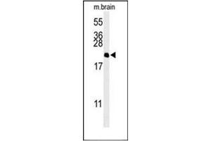 Western blot analysis of NP1L5 Antibody (Center) in Mouse brain tissue lysates (35ug/lane). (NAP1L5 Antikörper  (Middle Region))