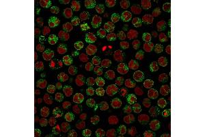 Immunofluorescence Analysis of Raji cells. (CD79a Antikörper)
