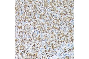 Immunohistochemistry of paraffin-embedded rat ovary using RPS15A Rabbit pAb (ABIN6131092, ABIN6147201, ABIN6147202 and ABIN6214414) at dilution of 1:200 (40x lens). (RPS15A Antikörper  (AA 1-130))