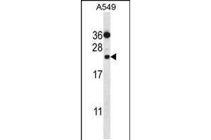 Western blot analysis in A549 cell line lysates (35ug/lane). (PSMD10 Antikörper  (C-Term))