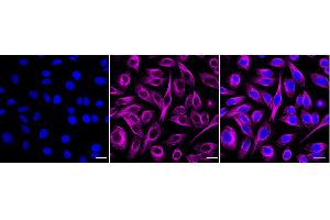 Immunocytochemical staining of HepG2 cells with Pannexin 1 antibody (ABIN7799733), 1:1,000).