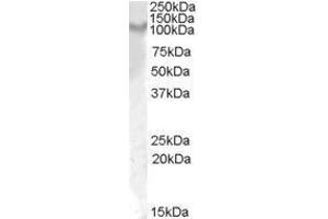 Anti-IL17ra (1µg/ml) staining of Rat Kidney lysate (35µg protein in RIPA buffer). (IL17RA Antikörper  (Internal Region))