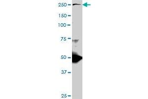TLN1 monoclonal antibody (M06), clone 2E10. (TLN1 Antikörper  (AA 1052-1149))