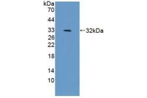 Detection of Recombinant BAFF, Mouse using Polyclonal Antibody to B-Cell Activating Factor (BAFF) (BAFF Antikörper  (AA 68-283))