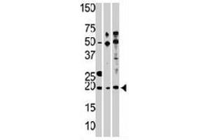 Western blot analysis of RPL23A polyclonal antibody , from left to right, CEM, Hela, and HepG2 cell line lysates (35 ug/lane). (RPL23A Antikörper  (C-Term))