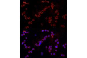 Immunofluorescence analysis of THP-1 cells using NLRC4 Rabbit pAb (ABIN6129418, ABIN6144657, ABIN6144659 and ABIN6223243) at dilution of 1:100 (40x lens). (NLRC4 Antikörper  (AA 1-250))