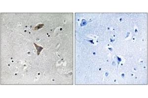 Immunohistochemistry analysis of paraffin-embedded human brain tissue, using KCNT1 Antibody. (KCNT1 Antikörper  (AA 1019-1068))