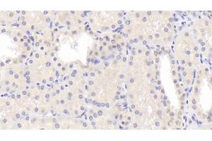 Detection of LPCAT1 in Human Kidney Tissue using Polyclonal Antibody to Lysophosphatidylcholine Acyltransferase 1 (LPCAT1) (LPCAT1 Antikörper  (AA 70-237))