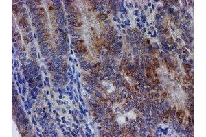 Image no. 6 for anti-Chromosome 21 Open Reading Frame 56 (C21orf56) antibody (ABIN1497041) (C21ORF56 Antikörper)