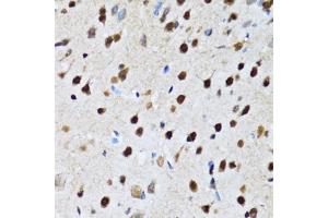 Immunohistochemistry of paraffin-embedded rat brain using CC antibody (ABIN6133528, ABIN6138034, ABIN6138035 and ABIN6222941) at dilution of 1:100 (40x lens). (CCAR2 Antikörper  (AA 654-923))